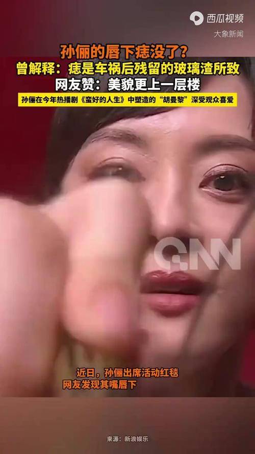 2025新澳正版今晚资料网站和孙俪唇下痣没了与孙俪嘴痣